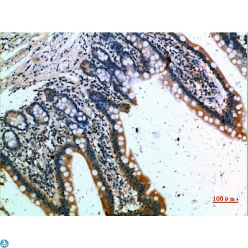 Polyclonal Rabbit anti-Human CCR1 Antibody (IHC)