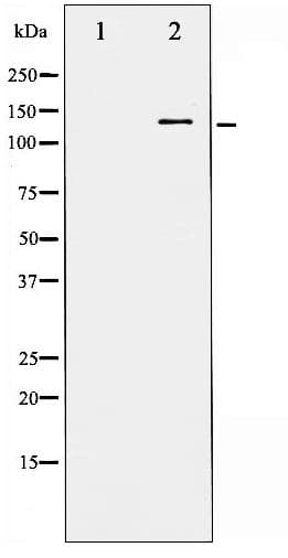 FGFR1 / FGF Receptor 1 Antibody (phospho-Tyr766)