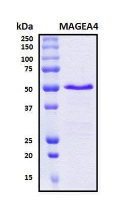 Human MAGEA4 Protein (Recombinant His, N-Terminal)