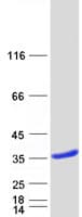 Human LGALS8 / Galectin 8 Protein (Recombinant Myc-DDK (Flag))