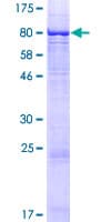 Human ST7 Protein (Recombinant GST)