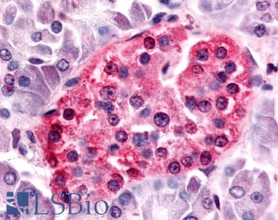 IHC-plus™ Polyclonal Rabbit anti-Human SGK3 Antibody (Internal, IHC)