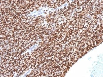 NKX2-2 Antibody (clone NX2/1524, Azide-free, BSA-free)