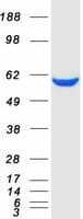 Human PKM / Pyruvate Kinase, Muscle Protein (Recombinant Myc-DDK (Flag))