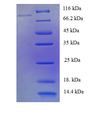 Human PTPN6 / SHP1 Protein (Recombinant His-SUMO)