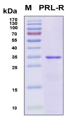 Human PRLR / Prolactin Receptor Protein (Recombinant 6His, N-terminus)