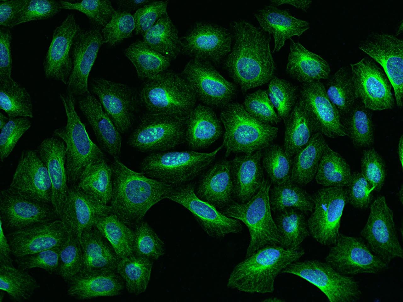 TBCA Antibody