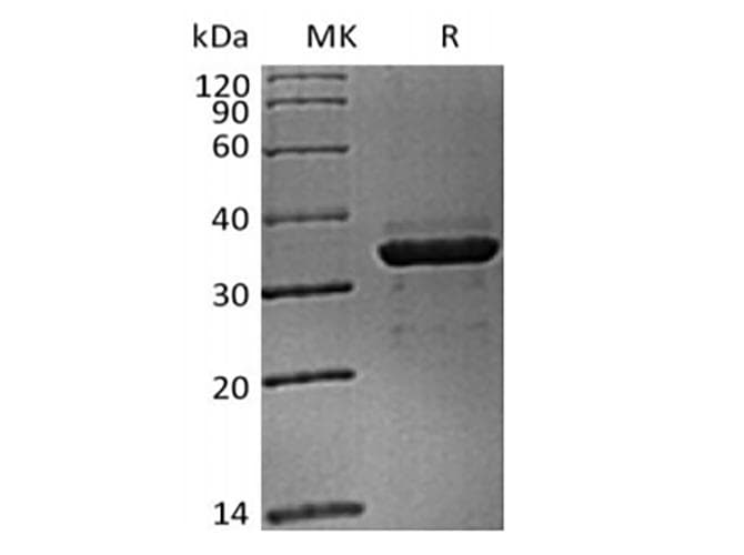 Cynomolgus ANGPTL4 Protein (Recombinant 6His, C-terminus)