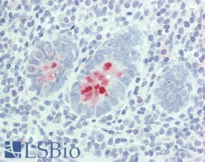 IHC-plus™ PRSS2 / Trypsin 2 Antibody (aa79-108)