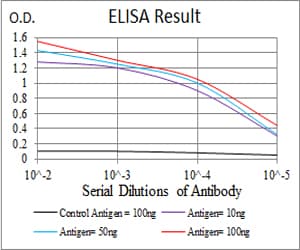 Monoclonal Mouse anti-Human MGMT Antibody (clone 1A11A8, WB)