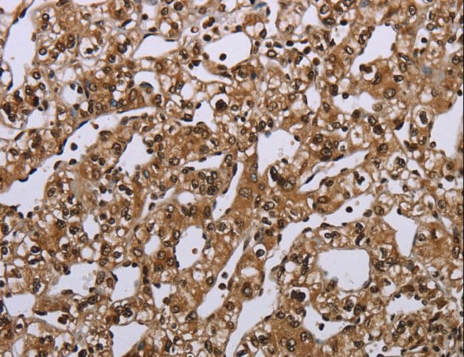Polyclonal Rabbit anti-Human MEIS1 Antibody (IHC)