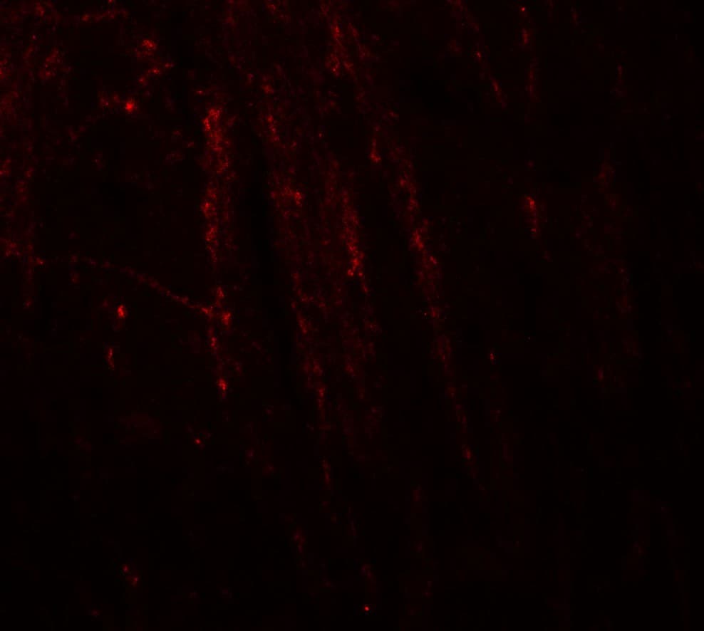 RHOT1 Antibody