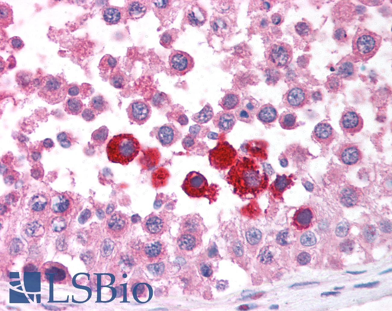 IHC-plus™ CHEK2 / CHK2 Antibody