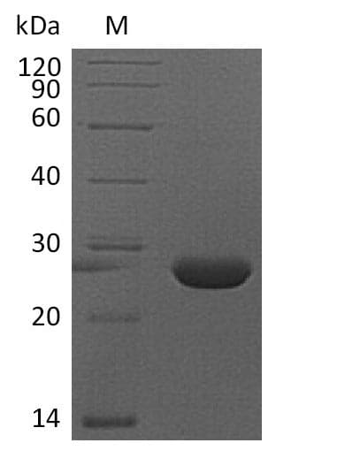 Mouse FGF9 Protein (Recombinant 6His, C-terminus)