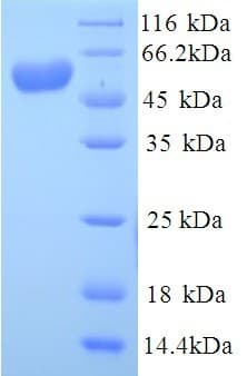 Human ALPI / Alkaline Phosphatase Protein (Recombinant His)