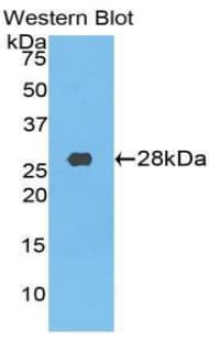 CD71 / Transferrin Receptor Antibody (aa585-771)
