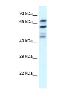 EIF2B5 Antibody (N-Terminus)