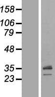 SCAMP1 / SCAMP Protein (Over-Expression Lysate Myc-DDK (Flag))