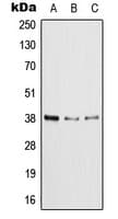 Polyclonal Rabbit anti-Human XRCC4 Antibody (C-Terminus, WB)