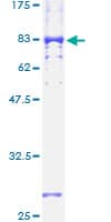 Human VRK2 Protein (Recombinant GST)