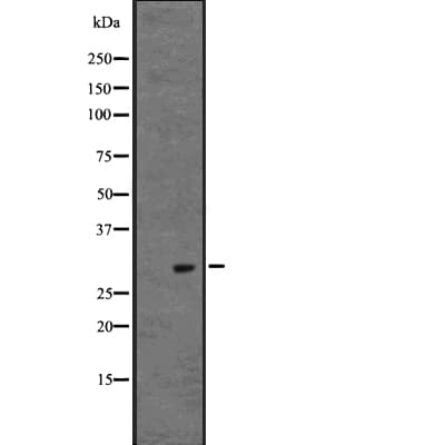 Polyclonal Rabbit anti-Human POMC / Proopiomelanocortin Antibody (WB)