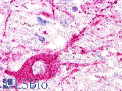PathPlus™ Polyclonal Rabbit anti-Human MAS1L / MRG Antibody (C-Terminus, IHC)