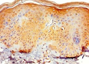 RNF125 / TRAC-1 Antibody (aa1-232)