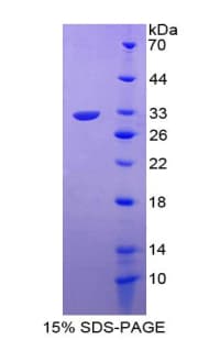 Human FGF5 Protein (Recombinant His-T7)