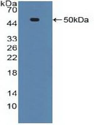 TNFRSF1A / TNFR1 Antibody (aa60-236, APC)