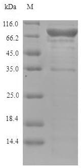 Human LOXL4 / LOXC Protein (Recombinant 6His, N-terminus)