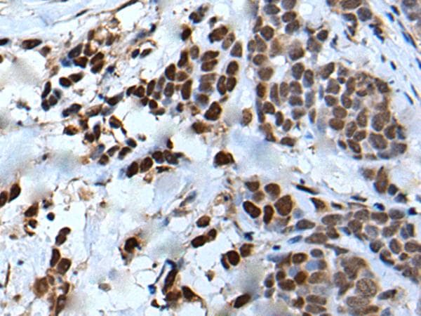 VEZT / Verzatin Antibody