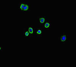 A2M / Alpha-2-Macroglobulin Antibody