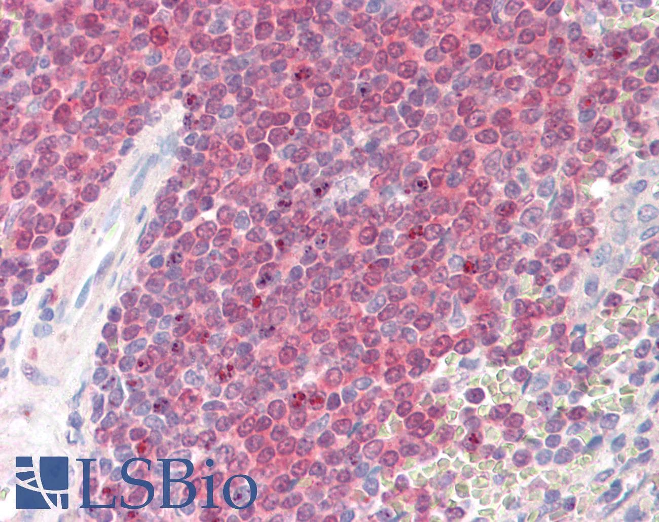 IHC-plus™ POU2AF1 / BOB1 Antibody (aa241-254)