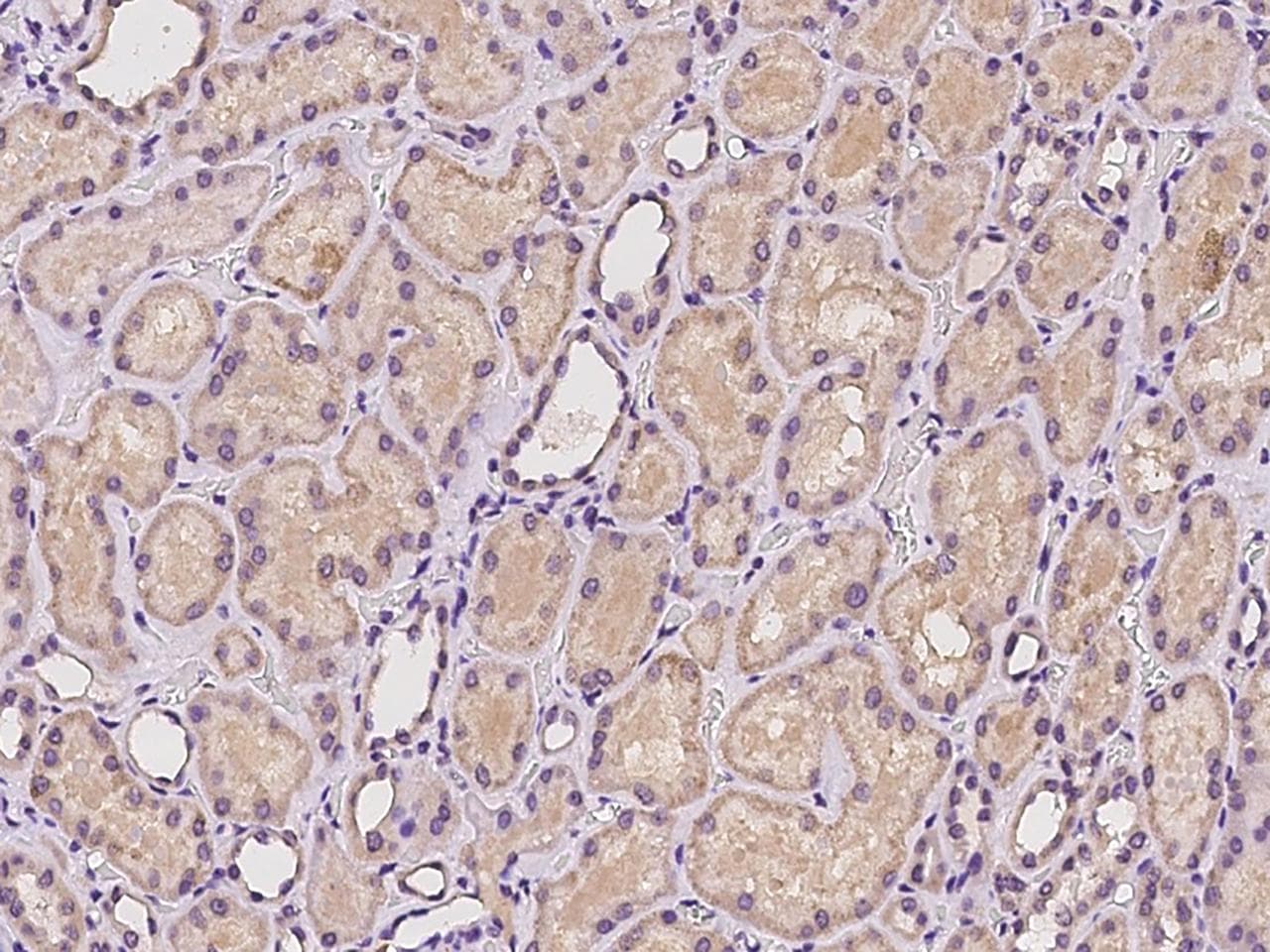 RPL23A Antibody