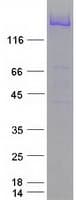 Human NEFH / NF-H Protein (Recombinant Myc-DDK (Flag))