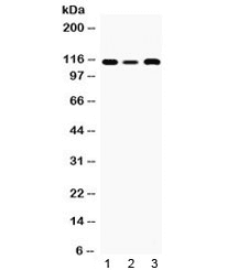 SMARCA3 / HLTF Antibody