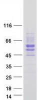 Human SIGIRR Protein (Recombinant Myc-DDK (Flag))