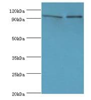 Polyclonal Rabbit anti-Human NVL Antibody (aa340-520, IHC, WB)