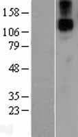 JAG1 / Jagged 1 Protein (Over-Expression Lysate Myc-DDK (Flag))