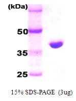 Human HTRA2 / OMI Protein (Recombinant His, C-Terminal)