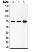 Polyclonal Rabbit anti-Human F13A1 / Factor XIIIa Antibody (N-Terminus, WB)