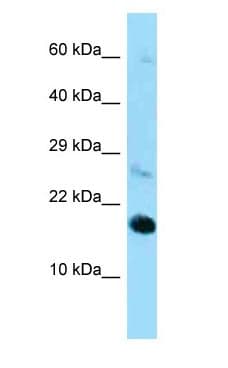 RPL22 / Ribosomal Protein L22 Antibody (C-Terminus)
