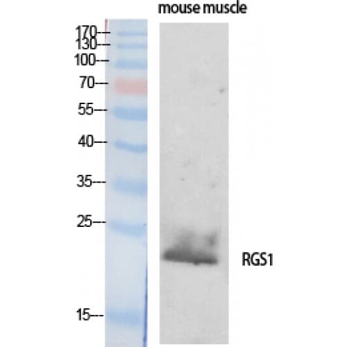 RGS1 Antibody (90-170 aa, Internal)