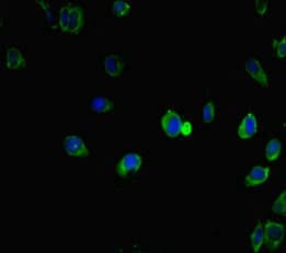 Polyclonal Rabbit anti-Human IRF5 Antibody (IHC, IF, WB)