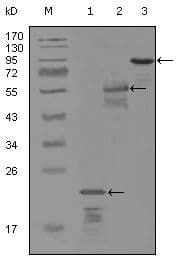 Monoclonal Mouse anti-Human ERBB3 / HER3 Antibody (clone 2B11D11, Amino Acid: 1175-1275, WB)