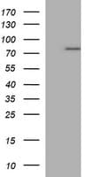 TP73 / p73 Antibody (aa167-409, clone OTI1B5)
