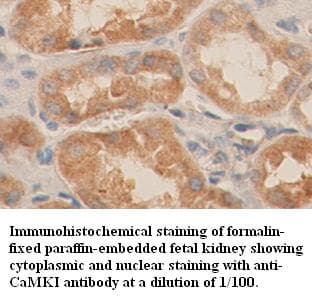 CAMK1 / CAMKI Antibody (C-Terminus)