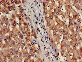 PRDM2 / RIZ1 Antibody