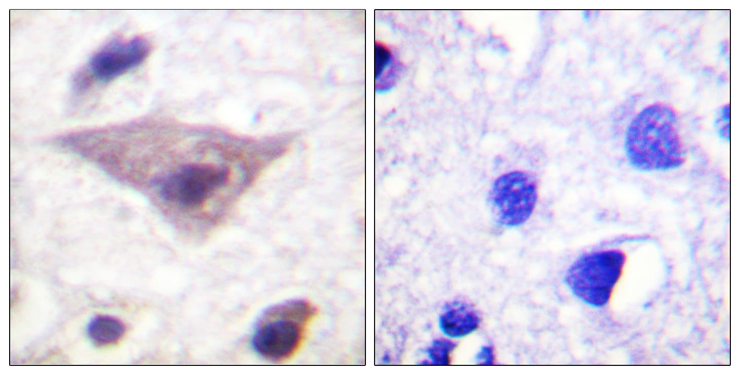 Polyclonal Rabbit anti-Human Synuclein Antibody (phospho-Ser129, IHC, WB)