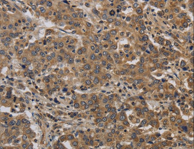Polyclonal Rabbit anti-Human KIF4A Antibody (IHC)